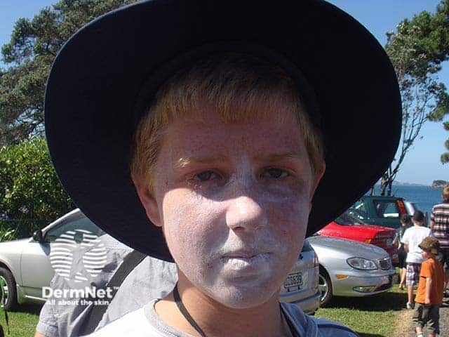 Modern sunscreen have micronised mineral contents and chemical absorbers that are less apparent