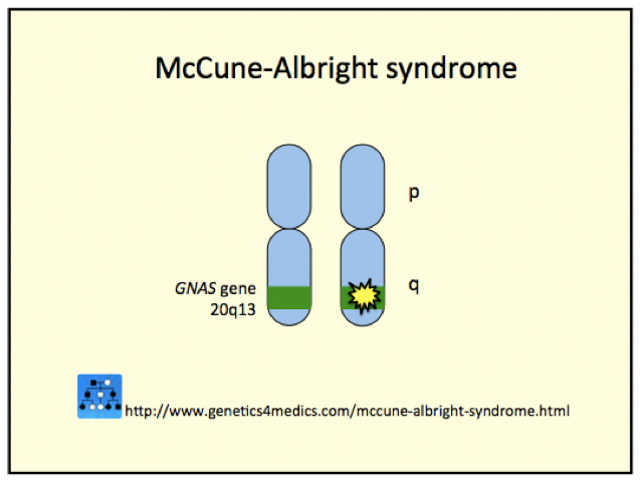 Genetics of McCune–Albright syndrome*