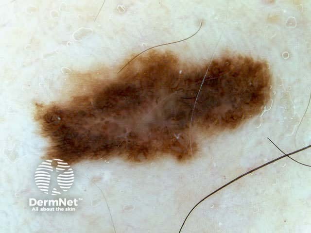 Irregular shape/structure