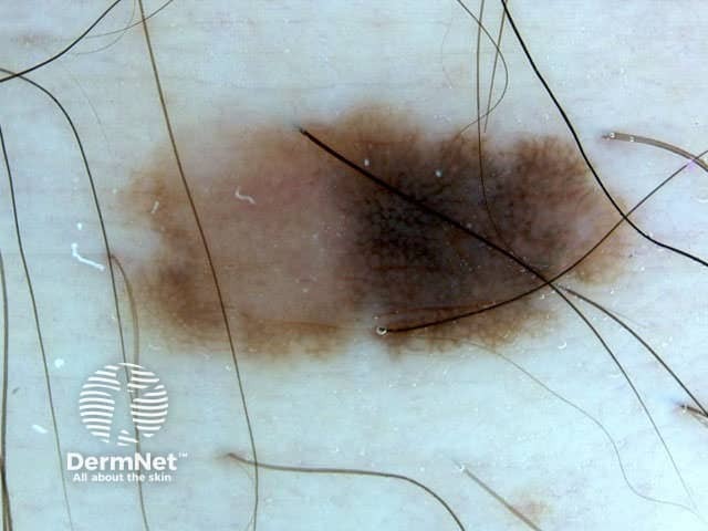 Asymmetrical pattern