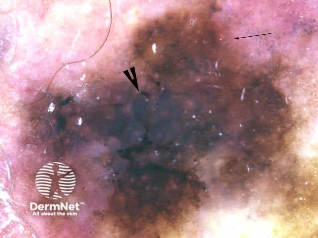 Irregular shape/structure