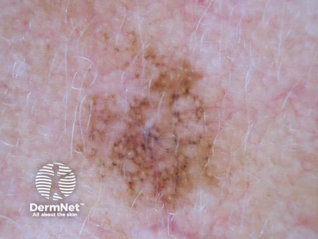 Chaos + eccentric structureless area, polygons