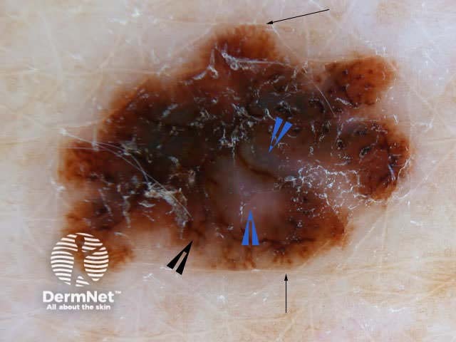 Irregular shape/structure