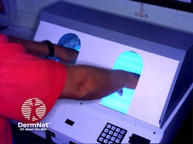 Small PUVA unit for hand/foot treatment