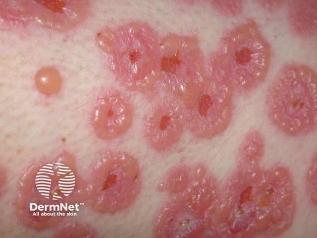 String of beads sign