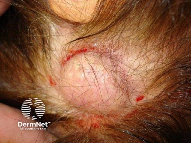 Image from Dr Calum Lyon