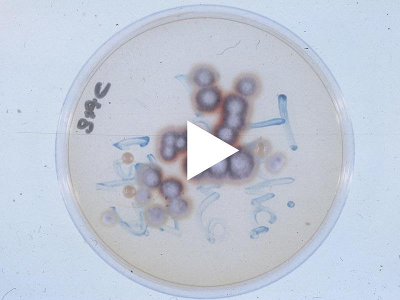 Watch video: Taking a mycology sample